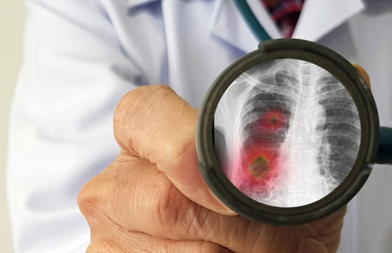 إليكم طرائف ومواقف وأحداث سببها فيروس كورونا المستجد صورة رقم 5 إليكم طرائف ومواقف وأحداث سببها فيروس كورونا المستجد صورة رقم 5