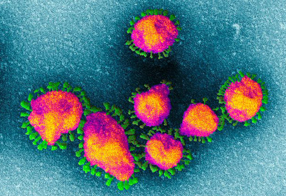 إليكم طرائف ومواقف وأحداث سببها فيروس كورونا المستجد صورة رقم 7 إليكم طرائف ومواقف وأحداث سببها فيروس كورونا المستجد صورة رقم 7