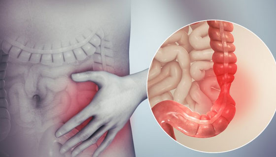 4 علامات لإصابتك بالتهاب القولون العصبي صورة رقم 6