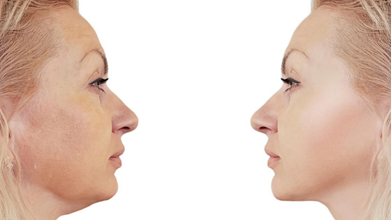 بينها البيض والقهوة... 4 خلطات طبيعية لشد الوجه صورة رقم 5