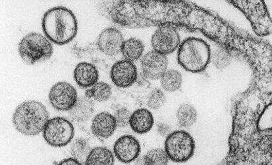 بعد إعلان الصين عن حالة وفاة.. كل ما تريد معرفته عن فيروس هانتا! صورة رقم 3