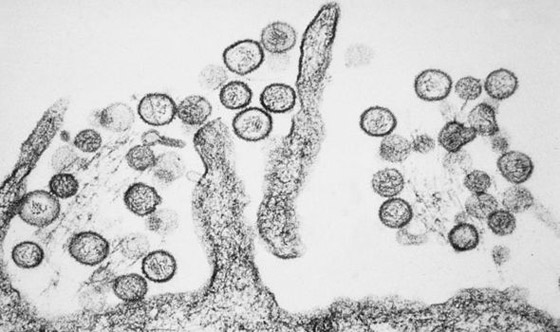 بعد إعلان الصين عن حالة وفاة.. كل ما تريد معرفته عن فيروس هانتا! صورة رقم 8