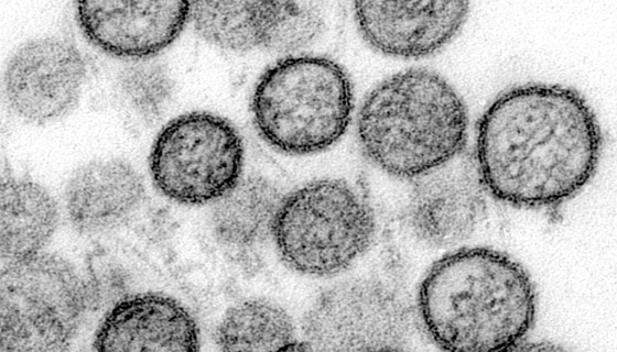 بعد إعلان الصين عن حالة وفاة.. كل ما تريد معرفته عن فيروس هانتا! صورة رقم 14