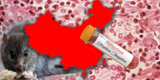 بعد إعلان الصين عن حالة وفاة.. كل ما تريد معرفته عن فيروس هانتا! صورة رقم 10