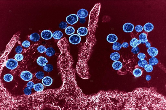 بعد إعلان الصين عن حالة وفاة.. كل ما تريد معرفته عن فيروس هانتا! صورة رقم 12