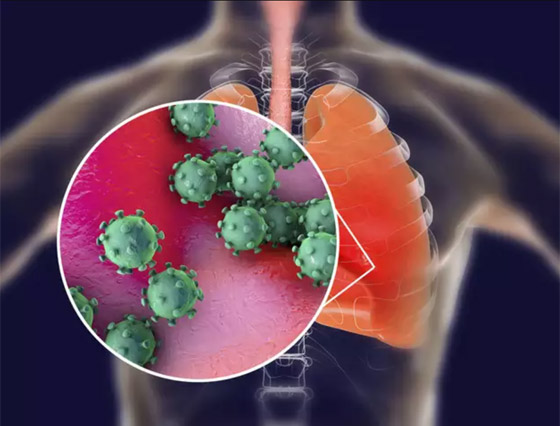 بالفيديو.. كيف تبدو رئة مصاب بفيروس كورونا وما يحصل داخلها؟ صورة رقم 11