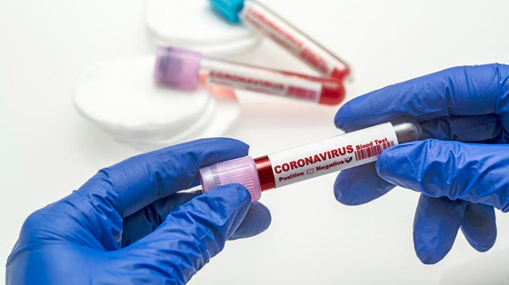 هل يمكن أن نصاب بفيروس كورونا مرتين؟ صورة رقم 13