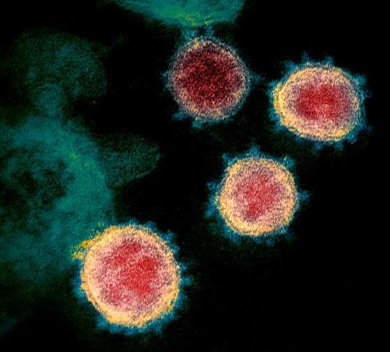 هل يمكن أن نصاب بفيروس كورونا مرتين؟ صورة رقم 11