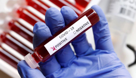 كيف يؤثر فيروس كورونا على الكبد؟.. هذا سر وفاة الأصحاء! صورة رقم 8 كيف يؤثر فيروس كورونا على الكبد؟.. هذا سر وفاة الأصحاء! صورة رقم 8