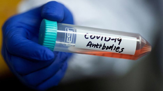 أعراض جديدة خطيرة لكورونا.. آثار الفيروس تصل إلى الدماغ! صورة رقم 4 أعراض جديدة خطيرة لكورونا.. آثار الفيروس تصل إلى الدماغ! صورة رقم 4