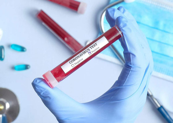 أعراض جديدة خطيرة لكورونا.. آثار الفيروس تصل إلى الدماغ! صورة رقم 10 أعراض جديدة خطيرة لكورونا.. آثار الفيروس تصل إلى الدماغ! صورة رقم 10