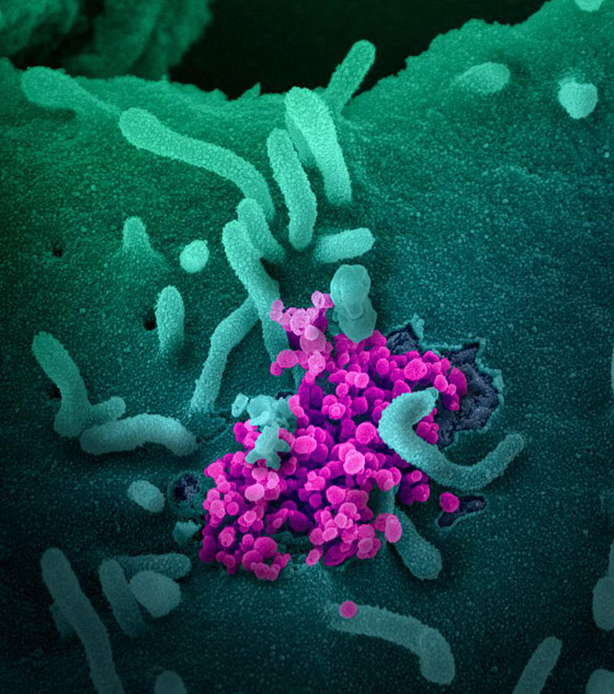 أعراض جديدة خطيرة لكورونا.. آثار الفيروس تصل إلى الدماغ! صورة رقم 17 أعراض جديدة خطيرة لكورونا.. آثار الفيروس تصل إلى الدماغ! صورة رقم 17