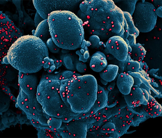 بالصور: شاهدوا فيروس كورونا (كوفيد 19) بعدسة المجهر صورة رقم 1