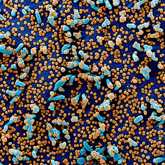 بالصور: شاهدوا فيروس كورونا (كوفيد 19) بعدسة المجهر صورة رقم 2