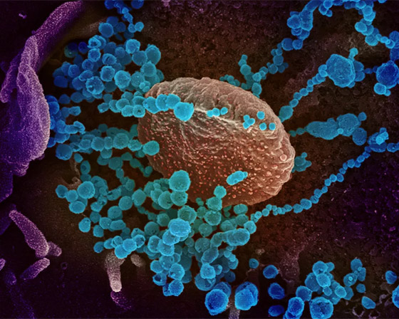 بالصور: شاهدوا فيروس كورونا (كوفيد 19) بعدسة المجهر صورة رقم 4