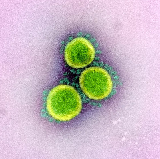 بالصور: شاهدوا فيروس كورونا (كوفيد 19) بعدسة المجهر صورة رقم 5