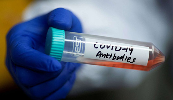 دراسة تحذر من إنهاء عمليات الإغلاق قبل تطوير لقاح لفيروس كورونا! صورة رقم 12 دراسة تحذر من إنهاء عمليات الإغلاق قبل تطوير لقاح لفيروس كورونا! صورة رقم 12