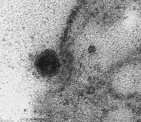 لأول مرة.. التقاط لحظة إصابة فيروس كورونا لخلية سليمة! صور صورة رقم 3 لأول مرة.. التقاط لحظة إصابة فيروس كورونا لخلية سليمة! صور صورة رقم 3