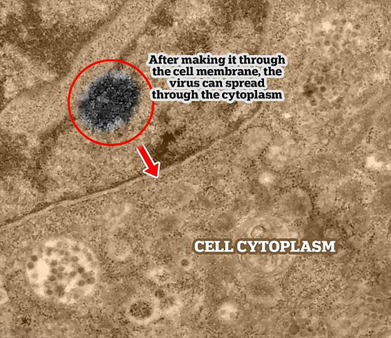 لأول مرة.. التقاط لحظة إصابة فيروس كورونا لخلية سليمة! صور صورة رقم 6 لأول مرة.. التقاط لحظة إصابة فيروس كورونا لخلية سليمة! صور صورة رقم 6