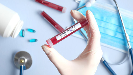 في حال إقراره.. هل سيكون ثمن علاج فيروس كورونا في متناول المرضى؟ صورة رقم 2 في حال إقراره.. هل سيكون ثمن علاج فيروس كورونا في متناول المرضى؟ صورة رقم 2