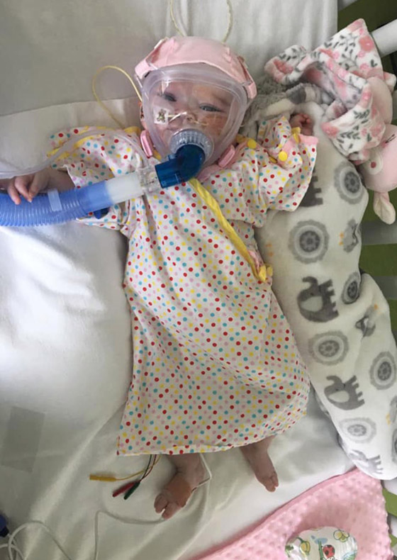 صور موجعة.. رضيعة بريطانية مريضة بالقلب تصاب بفيروس كورونا! صورة رقم 4