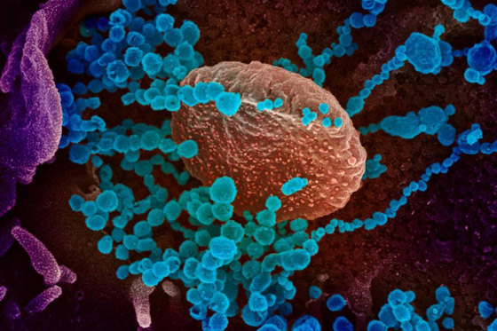 على عتبة المليونين إصابة.. أحدث تطورات كورونا من الصين لأمريكا والعالم صورة رقم 18