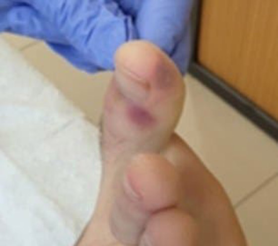 أعراض جديدة وغامضة لمصابي كورونا من الأطفال والمراهقين! صورة رقم 3