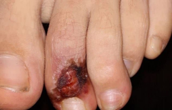 أعراض جديدة وغامضة لمصابي كورونا من الأطفال والمراهقين! صورة رقم 4