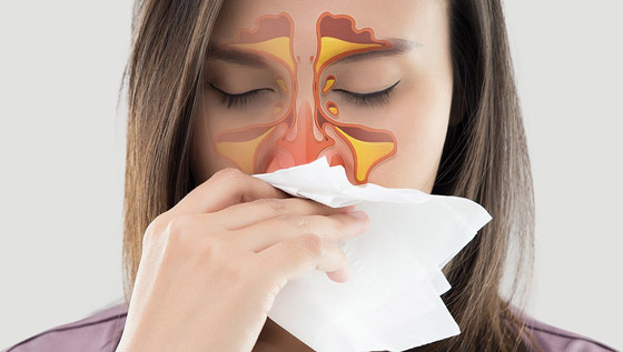 ما الفرق بين حساسية الأنف والتهاب الجيوب الأنفية؟.. هكذا نميّز بينهما صورة رقم 4