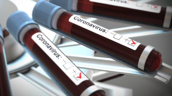 وباء كورونا: منظمة الصحة العالمية تحذر من التسرع بإنهاء حالة الإغلاق صورة رقم 7