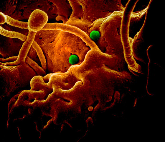 كورونا والنيكوتين.. علماء يختبرون النظرية المدهشة! صورة رقم 8