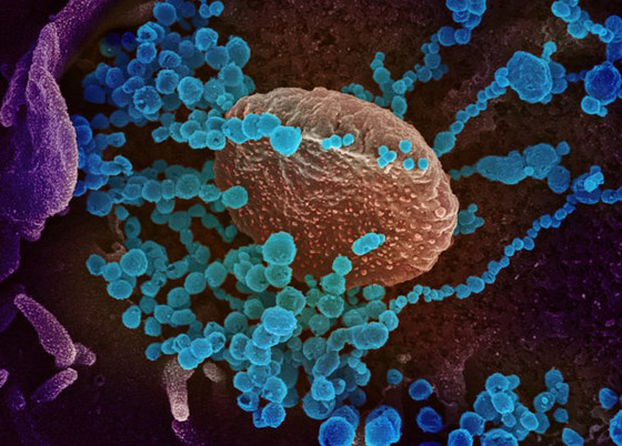 أمريكا: فيروس كورونا ليس نتاجا لنشاطات بشرية أو تحوير وراثي صورة رقم 6