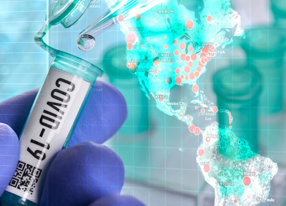 فيروس كورونا: الإعلان عن موعد ظهور لقاح مجاني للوباء في أكسفورد صورة رقم 2 فيروس كورونا: الإعلان عن موعد ظهور لقاح مجاني للوباء في أكسفورد صورة رقم 2