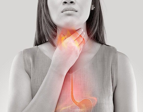 أسباب حموضة المعدة وعلاجها صورة رقم 1