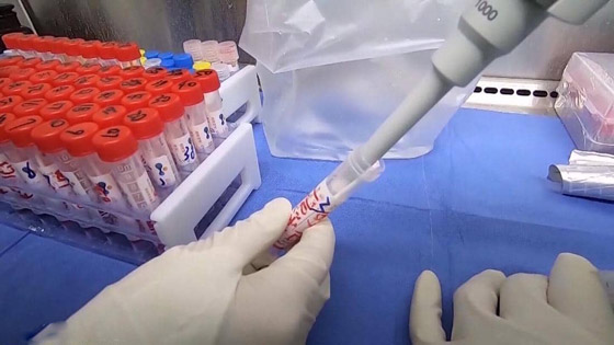 طفرة جديدة تطرأ على فيروس كورونا.. وآمال بتحوله إلى فيروس وديع! صورة رقم 3 طفرة جديدة تطرأ على فيروس كورونا.. وآمال بتحوله إلى فيروس وديع! صورة رقم 3