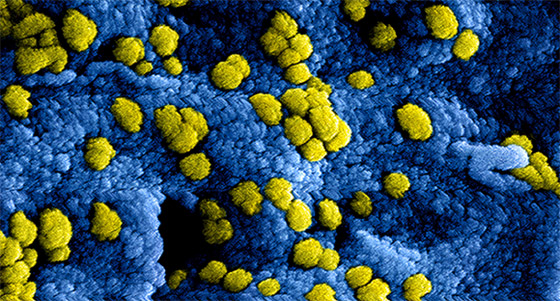ضربة لوباء كورونا في الصين وكوريا الجنوبية.. وذعر من موجة ثانية صورة رقم 3 ضربة لوباء كورونا في الصين وكوريا الجنوبية.. وذعر من موجة ثانية صورة رقم 3