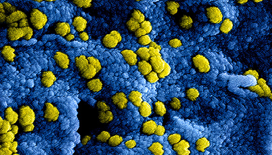 علماء يحذرون من تكيّف فيروس كورونا مع البشر! صورة رقم 3