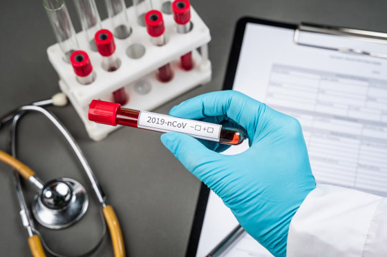 تحذير عالمي: فيروس كورونا لم يتغير وما زال فتاكا ينتشر بخطورة! صورة رقم 3