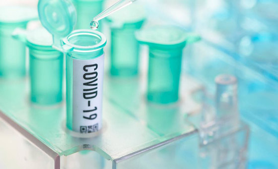 الصين وأمريكا تسابقان الزمن: من أين سيأتي اللقاح؟ ولغز جديد لكورونا! صورة رقم 11