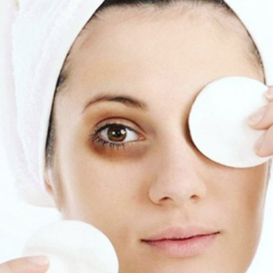 5 وصفات للتخلّص من الهالات السوداء حول العينين صورة رقم 1