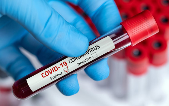 دولة عربية هي الأفضل في مكافحة كورونا حتى الآن.. وخبر سار لللقاح صورة رقم 7 دولة عربية هي الأفضل في مكافحة كورونا حتى الآن.. وخبر سار لللقاح صورة رقم 7