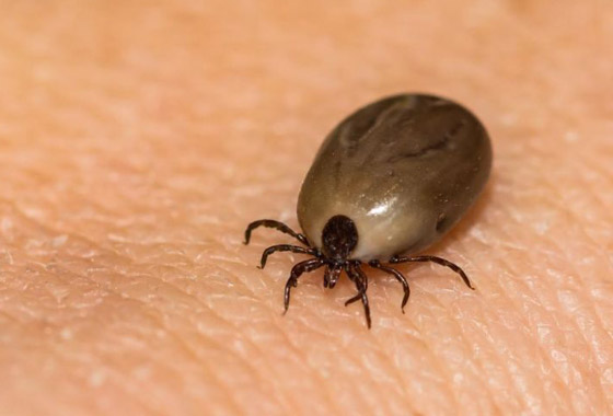 أعراض تشبه مرض كورونا.. والسبب لدغة حشرة القراد! صورة رقم 3 أعراض تشبه مرض كورونا.. والسبب لدغة حشرة القراد! صورة رقم 3