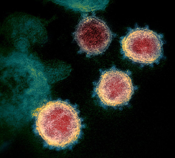 الموجة الثانية لوباء كورونا.. إليكم أبرز المعالم والمخاطر والآمال صورة رقم 28