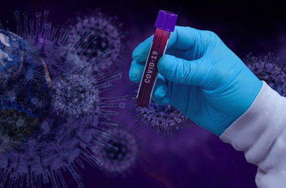 أسوأ حالة طوارئ صحية: ماذا يحدث إذا أصيب مرتدي الكمامة بكورونا؟ صورة رقم 8