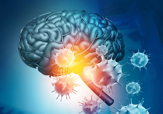 كورونا يلحق أضرارا بالمخ قد تصل للخرف.. نتائج مقلقة تذهل العلماء! صورة رقم 6