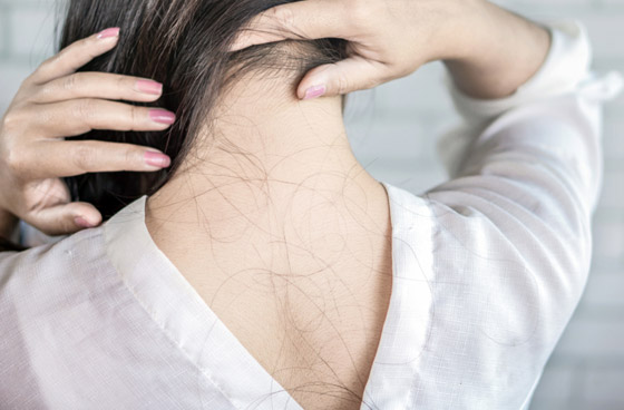 الشعر يقع بعد ظرف نفسي صعب.. ما العلاقة بين الإجهاد وتساقط الشعر؟ صورة رقم 1