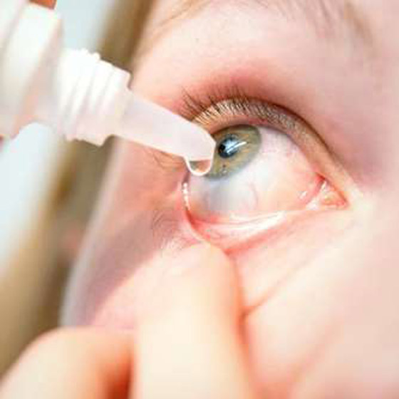 ما هي متلازمة عين المكتب؟ ان كنت تستعمل الكمبيوتر كثيرا قد تصيبك! صورة رقم 3