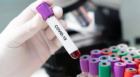 الصحة العالمية: نأمل انتهاء جائحة فيروس كورونا في أقل من عامين صورة رقم 14