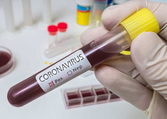 الصحة العالمية: نأمل انتهاء جائحة فيروس كورونا في أقل من عامين صورة رقم 15