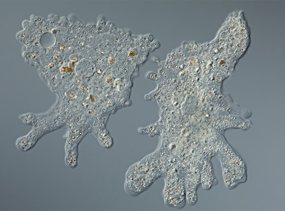 يصيب الدماغ ويدمره.. رصد أولى حالات لمرض خطير والأطباء بحالة رعب صورة رقم 8 يصيب الدماغ ويدمره.. رصد أولى حالات لمرض خطير والأطباء بحالة رعب صورة رقم 8